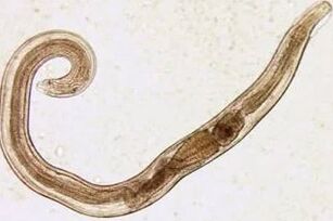 Parasites of a man with cuts