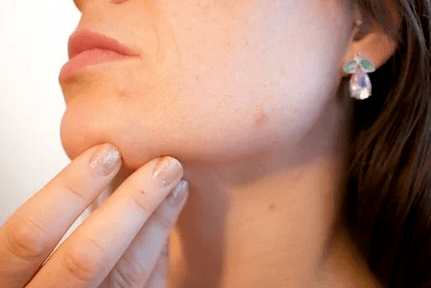 Skin problems