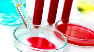 Blood analysis for parasites
